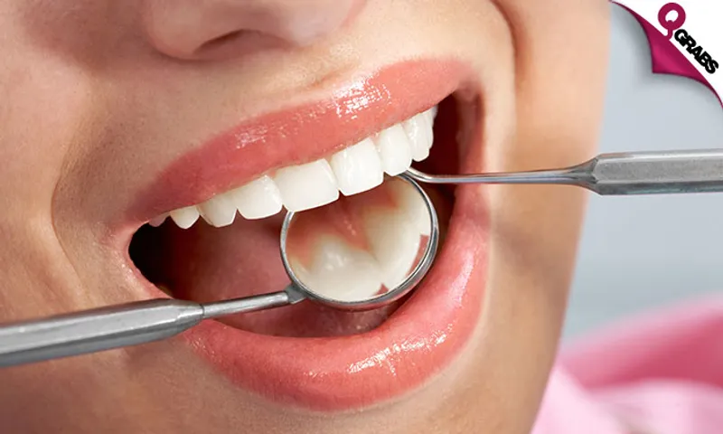 Dental Scaling, Polishing, Tooth Filling & More!